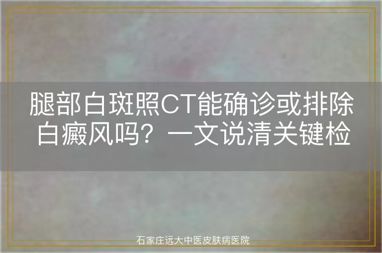 腿部白斑照CT能确诊或排除白癜风吗？一文说清关键检查方法