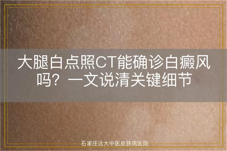 大腿白点照CT能确诊白癜风吗？一文说清关键细节