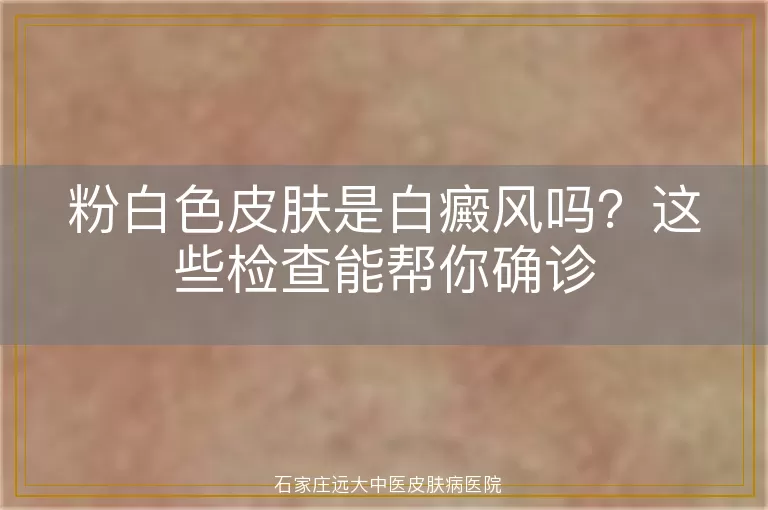 粉白色皮肤是白癜风吗？这些检查能帮你确诊