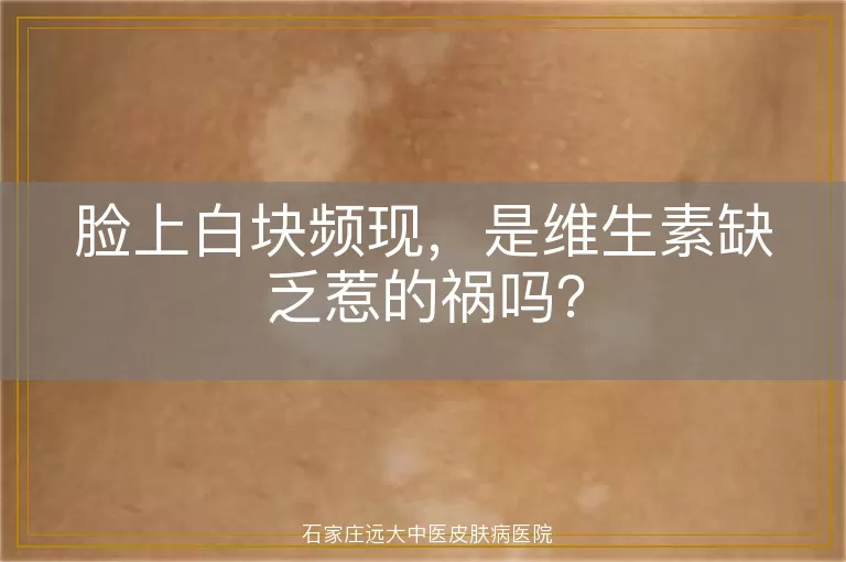 脸上白块频现，是维生素缺乏惹的祸吗？