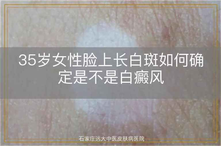 35岁女性脸上长白斑如何确定是不是白癜风