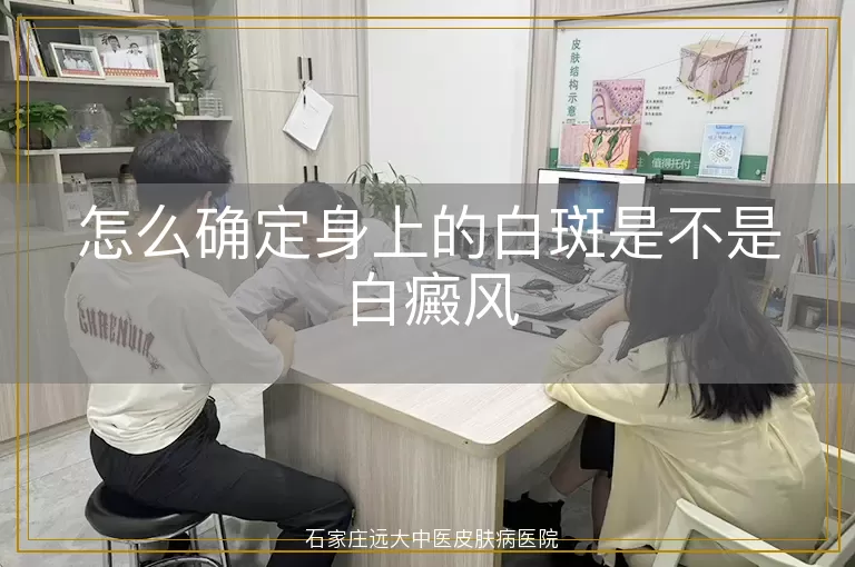怎么确定身上的白斑是不是白癜风