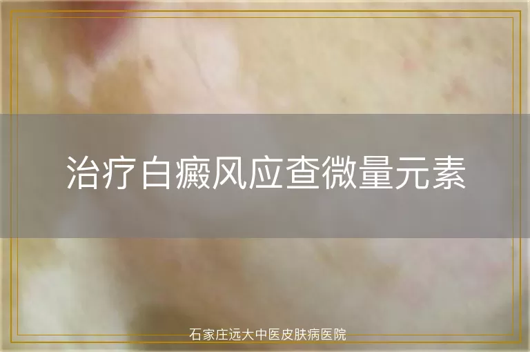 治疗白癜风应查微量元素