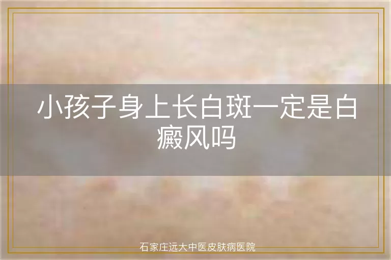 小孩子身上长白斑一定是白癜风吗