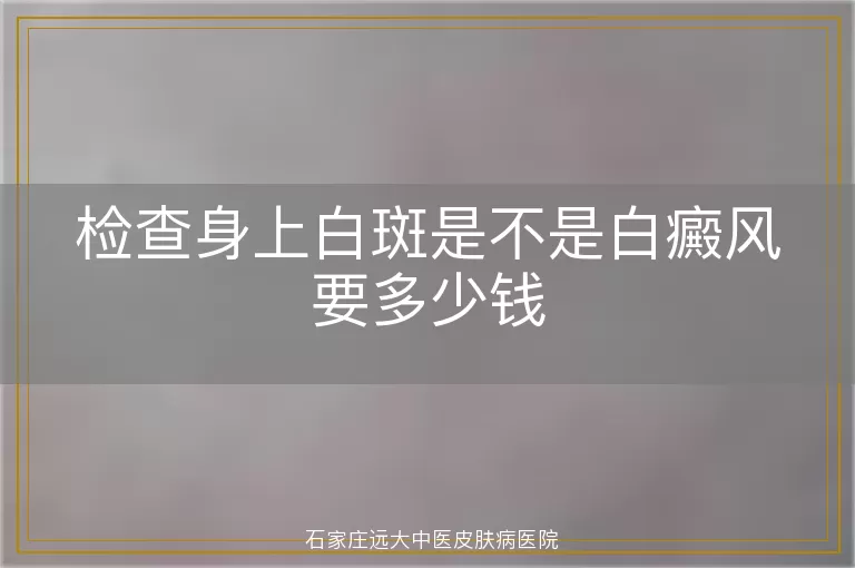 检查身上白斑是不是白癜风要多少钱