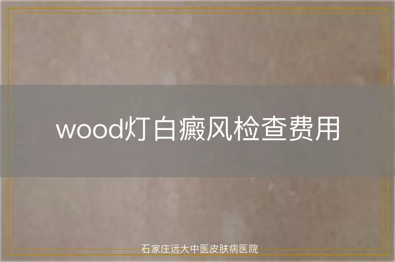 wood灯白癜风检查费用
