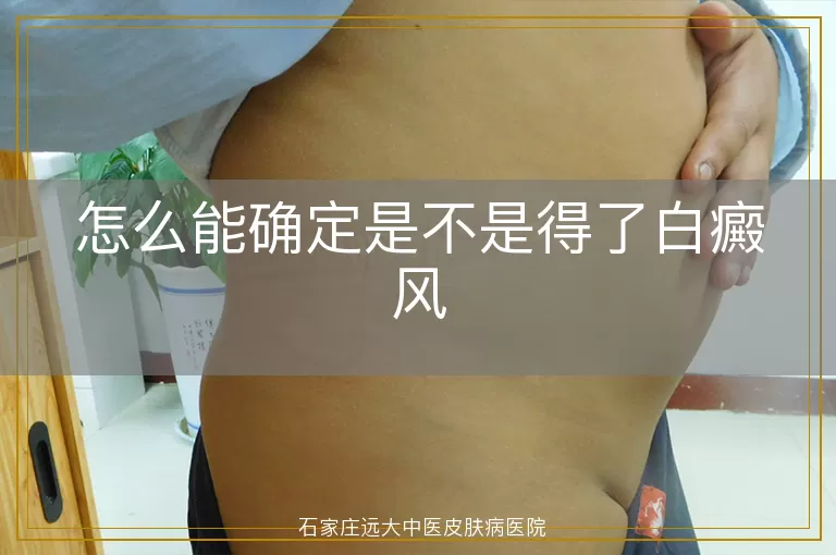 怎么能确定是不是得了白癜风