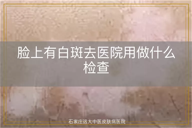 脸上有白斑去医院用做什么检查