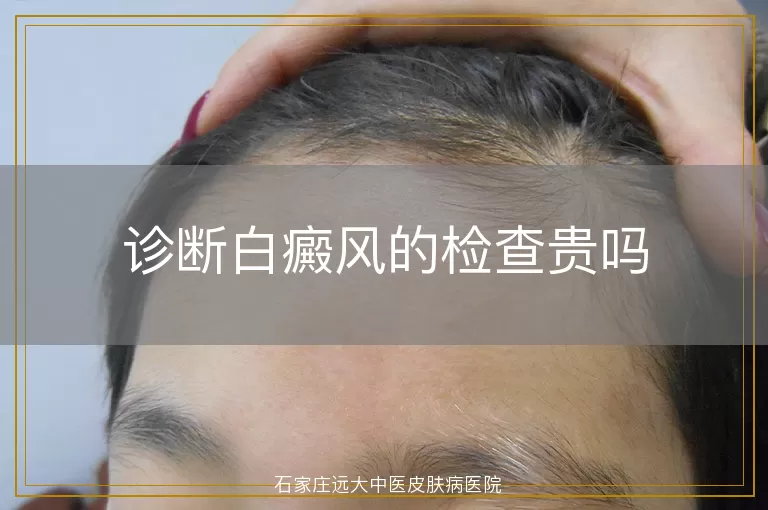 诊断白癜风的检查贵吗