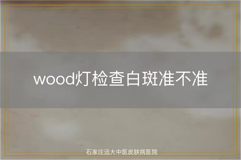 wood灯检查白斑准不准