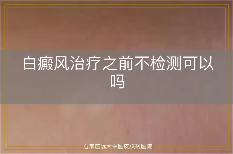 白癜风治疗之前不检测可以吗