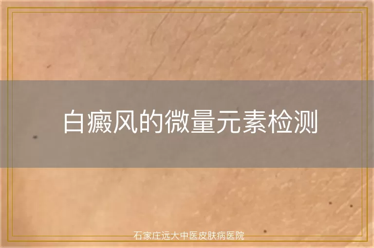 白癜风的微量元素检测