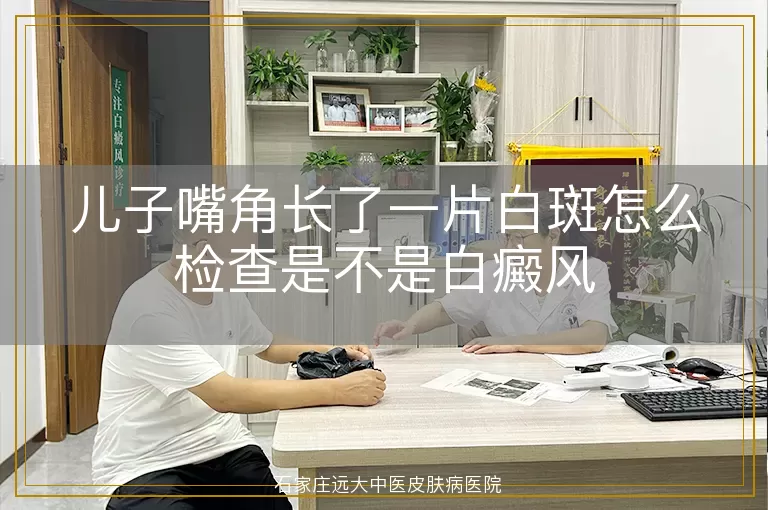 儿子嘴角长了一片白斑怎么检查是不是白癜风