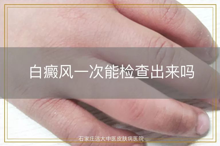 白癜风一次能检查出来吗