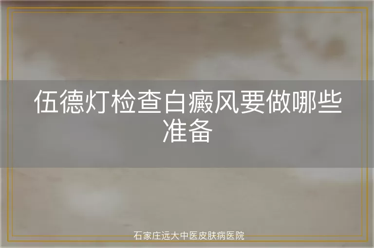 伍德灯检查白癜风要做哪些准备