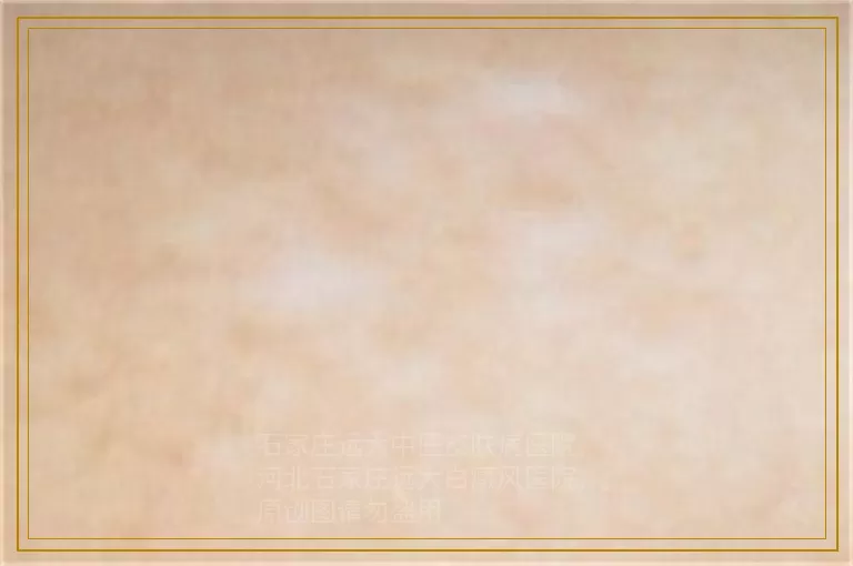 汗斑用伍德灯照也是白的吗