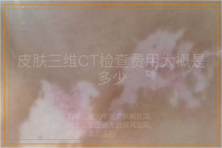 皮肤三维CT检查费用大概是多少