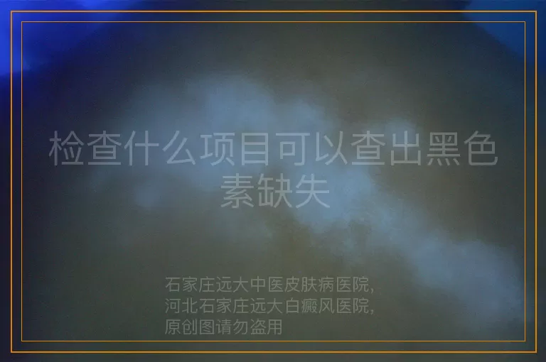 检查什么项目可以查出黑色素缺失