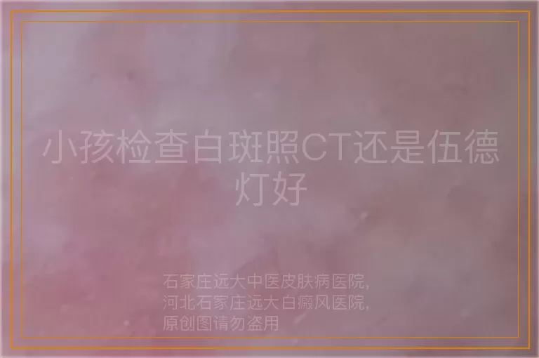 小孩检查白斑照CT还是伍德灯好