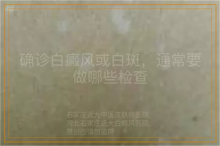 确诊白癜风或白斑，通常要做哪些检查