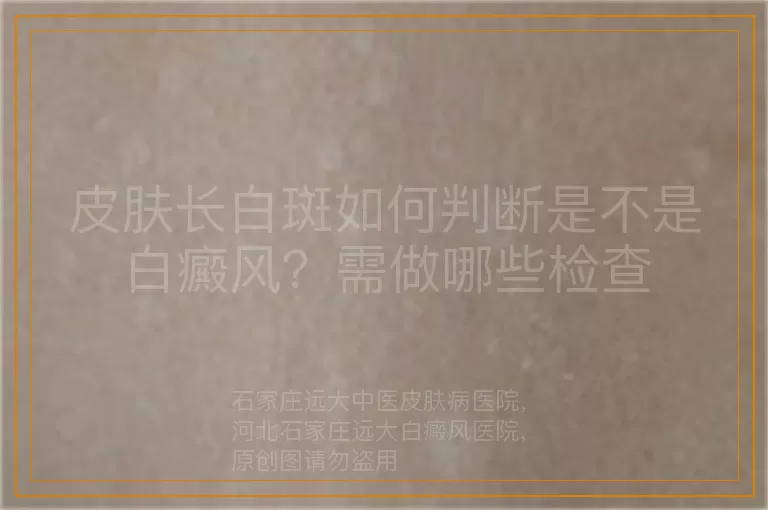 皮肤长白斑如何判断是不是白癜风？需做哪些检查