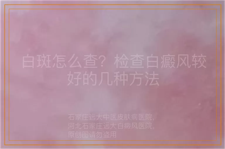 白斑怎么查？检查白癜风较好的几种方法