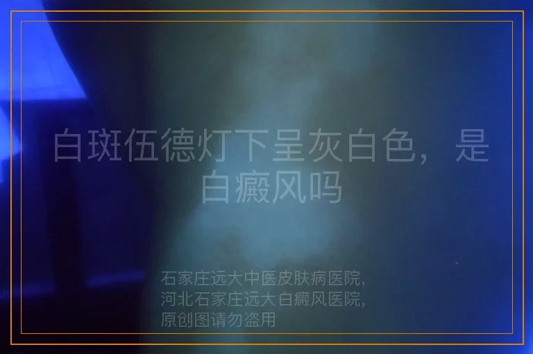 白斑伍德灯下呈灰白色，是白癜风吗