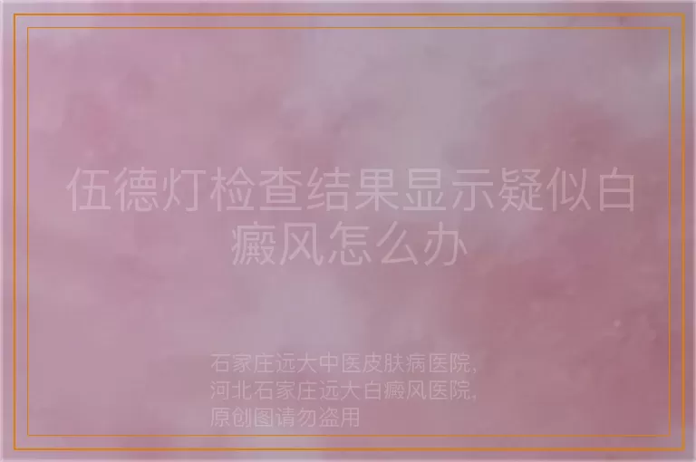 伍德灯检查结果显示疑似白癜风怎么办