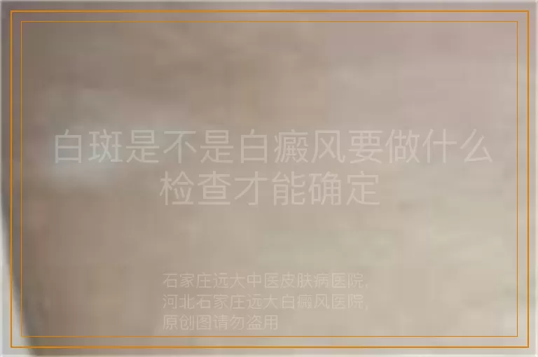 白斑是不是白癜风要做什么检查才能确定
