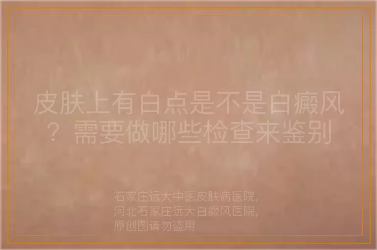 皮肤上有白点是不是白癜风？需要做哪些检查来鉴别