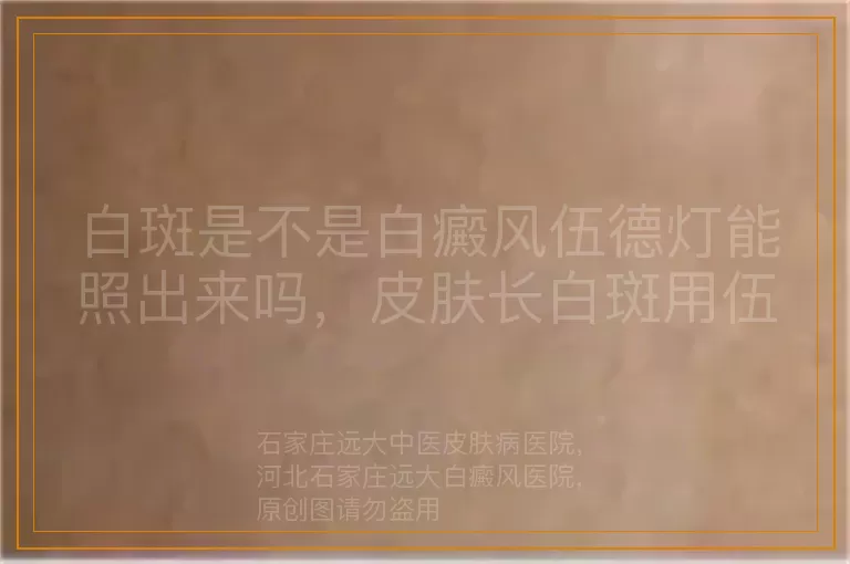 白斑是不是白癜风伍德灯能照出来吗，皮肤长白斑用伍德灯能分辨白癜风吗，白斑与白癜风用伍德灯检查能看出来吗