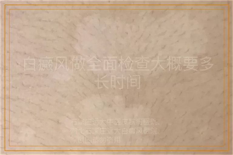 白癜风做全面检查大概要多长时间