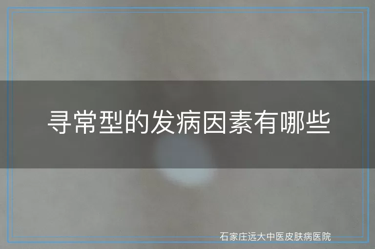 寻常型的发病因素有哪些
