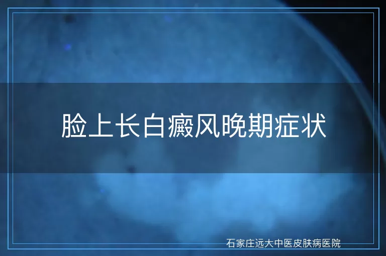 脸上长白癜风晚期症状
