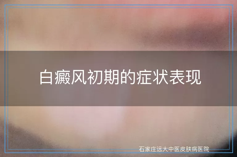 白癜风初期的症状表现