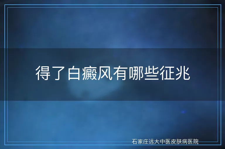 得了白癜风有哪些征兆