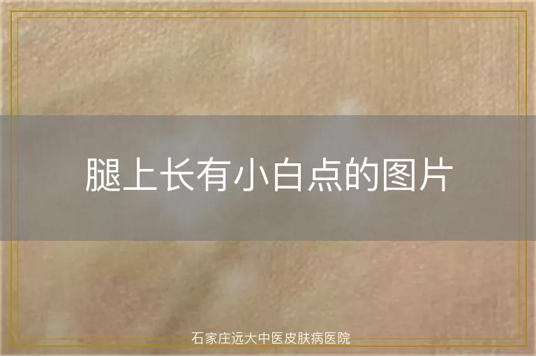 腿上长有小白点的图片