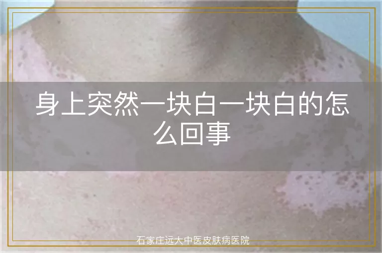 身上突然一块白一块白的怎么回事