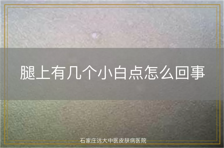 腿上有几个小白点怎么回事