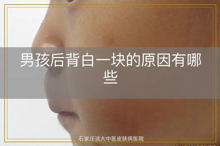 男孩后背白一块的原因有哪些