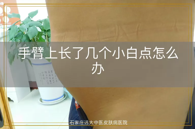手臂上长了几个小白点怎么办