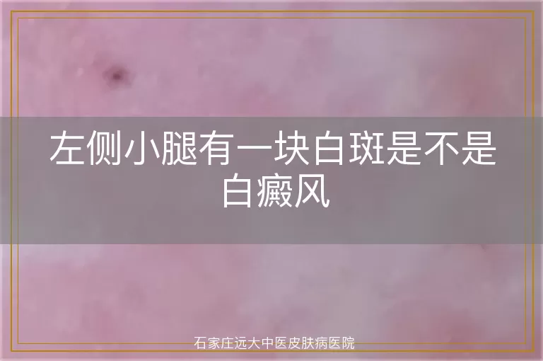 左侧小腿有一块白斑是不是白癜风