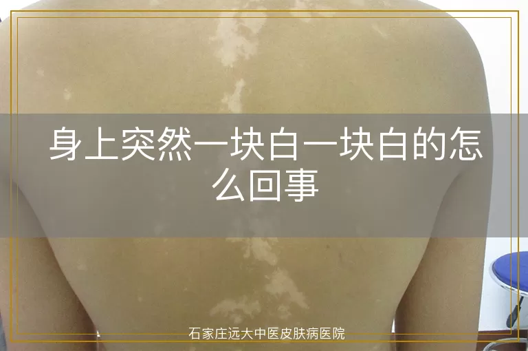 身上突然一块白一块白的怎么回事