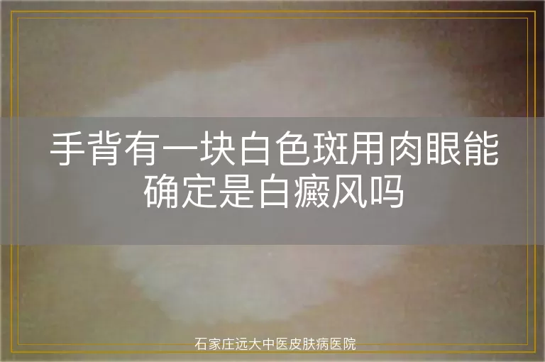 手背有一块白色斑用肉眼能确定是白癜风吗
