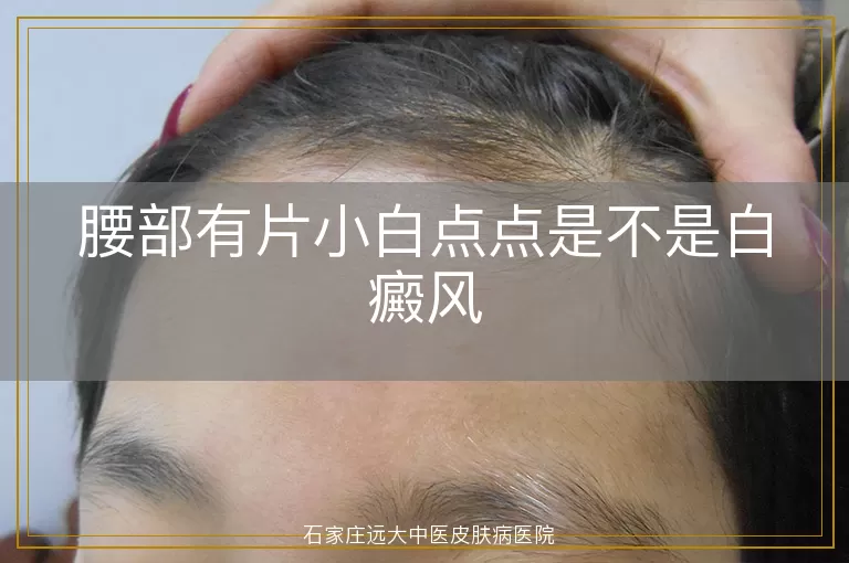 腰部有片小白点点是不是白癜风
