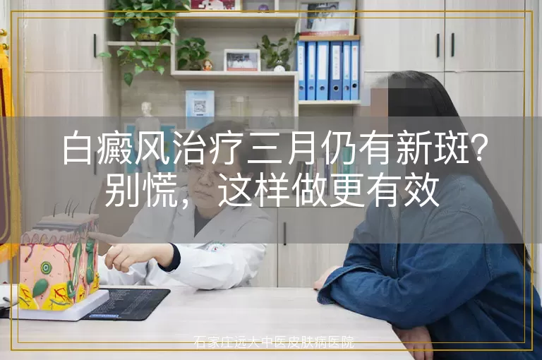 白癜风治疗三月仍有新斑？别慌，这样做更有效
