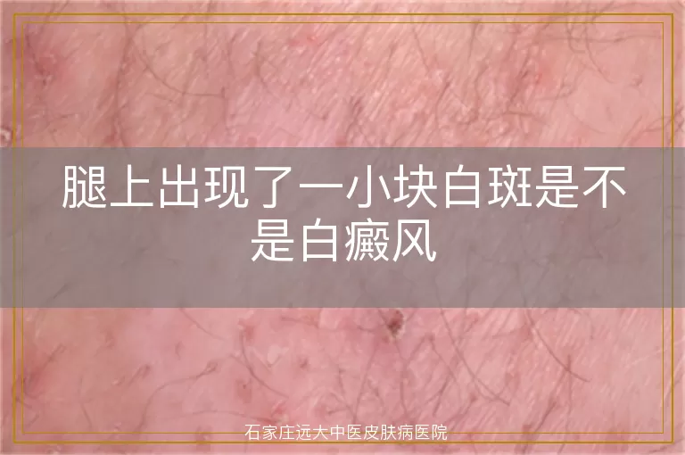 腿上出现了一小块白斑是不是白癜风