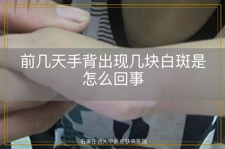 前几天手背出现几块白斑是怎么回事