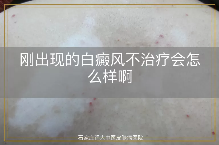 刚出现的白癜风不治疗会怎么样啊
