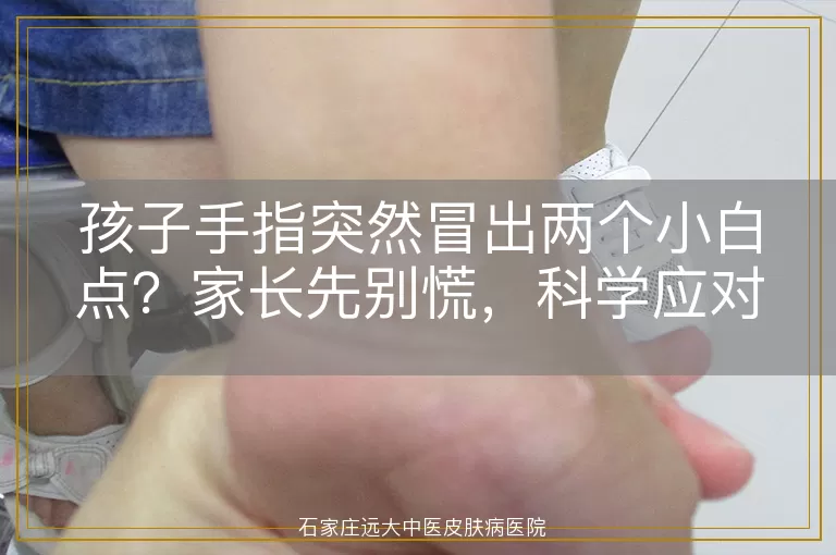 孩子手指突然冒出两个小白点？家长先别慌，科学应对指南来了